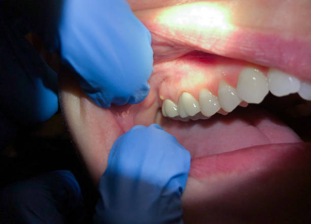 Best Emergency Dental Care for Trauma or Injury in Hyde Park, UT